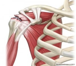 ROTATOR CUFF TEARS