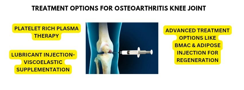 TREATMENT OPTIONS FOR OSTEOARTHRITIS KNEE JOINT